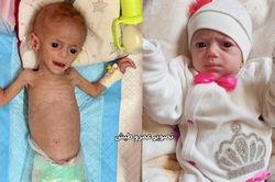 Bức ảnh gây chấn động thế giới: Câu chuyện đằng sau em bé Siwar Ashour ở Gaza