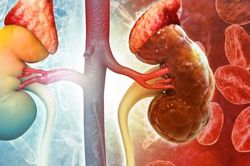 9 dấu hiệu cảnh báo suy thận, người trẻ cần chú ý