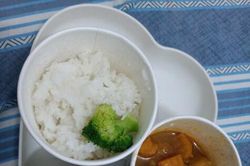 Nguyên nhân và tác hại của thừa cân béo phì ở trẻ em