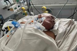 Giẫm phải gai nhọn, người đàn ông bị nhiễm trùng uốn ván, tính mạng nguy kịch