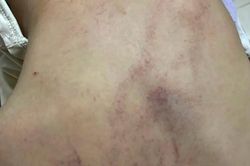 Tổng đài bảo vệ trẻ em 111 vào cuộc vụ nghi bạo hành trẻ em ở phường Bồ Đề