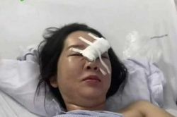 Mẫu thuẫn với vợ cũ, người cha chém gục con gái giữa đường