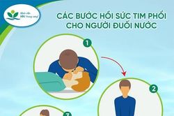Cách sơ cứu trẻ bị ngạt nước