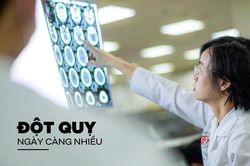 Vì sao đột quỵ ngày càng nhiều?
