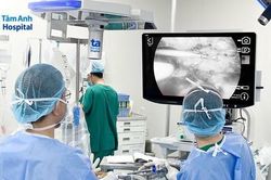 Hút thuốc lá nhiều năm, người đàn ông suýt mất bàn tay vì tắc mạch máu