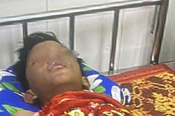 Vật lạ phát nổ, một học sinh lớp 6 bị bỏng nặng