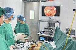 Sỏi ống mật chủ tái phát cẩn thận sốc nhiễm trùng đe dọa tính mạng