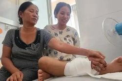 Ghép tạm bàn tay vào cẳng chân cho thai phụ, chờ nối lại