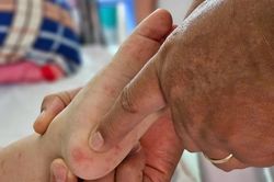 Một bệnh dự kiến tăng cao ở TP.HCM, bác sĩ khuyến cáo thận trọng