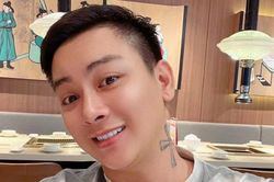 Từ Hoài Lâm xóa xăm, bác sĩ lưu ý rủi ro khi xăm và xóa hình