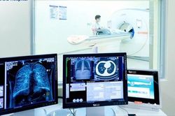 Ung thư phổi sau nhiều năm hút thuốc lá