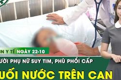Bản Tin Y Tế 22/10: Cứu người phụ nữ suy tim, phù phổi cấp do 'đuối nước trên cạn'