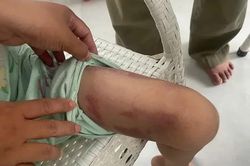 Bé gái 9 tuổi bị mẹ ruột cùng người tình đánh dã man trong phòng trọ