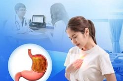 Trào ngược dạ dày thực quản có thể tiến triển ung thư