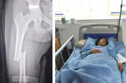 Khát vọng giảng đường đại học dang dở của nữ sinh mồ côi gặp tai nạn giao thông nghiêm trọng