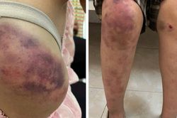 Mẹ bé gái bị bạo hành ở Thái Nguyên: 'Con tôi bị đánh suốt 4 tiếng liên tục, 2h sáng mới chạy thoát'