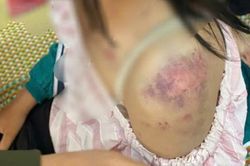 Vụ bé gái 13 tuổi bị bạo hành: Hành trình chạy trốn khỏi trận đòn sinh tử