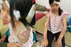 Ba kẻ tra tấn cháu gái suốt 4 giờ có thể bị khởi tố thêm nhiều tội danh