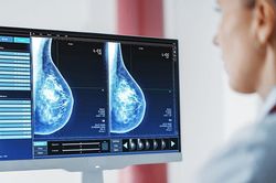 Công nghệ hình ảnh siêu nhạy giúp phát hiện ung thư sớm