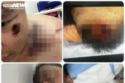 Ám ảnh trận đòn 'nhập môn' tại Trung tâm Công tác xã hội Hải Hà