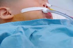 Bé trai 19 tháng tuổi nguy cơ di chứng vì ngộ độc hạt củ đậu