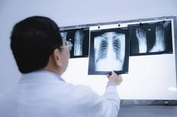 Đồng Nai đẩy nhanh ứng dụng AI khám chữa bệnh