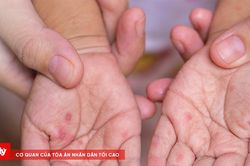 Tín hiệu vui về số ca sốt xuất huyết và tay chân miệng TP.HCM