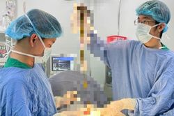 Mắc bệnh hiếm gặp, bé trai được các bác sĩ Đà Nẵng cứu chữa thành công