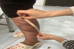 Bắc Ninh: Tạm giữ người đàn ông nhiều lần hành hạ vợ đang mang thai và con gái 13 tuổi