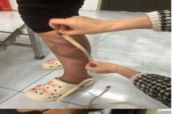 Tạm giữ người đàn ông nhiều lần bạo hành vợ đang mang thai và con gái 13 tuổi