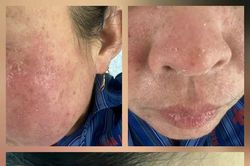 Trào lưu làm đẹp và những hệ lụy đối với sức khỏe