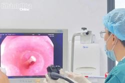 Bệnh viện 22-12 nội soi gắp răng giả ra khỏi thực quản cho bệnh nhân