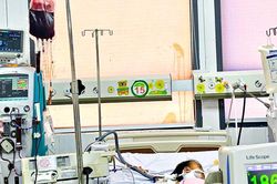 Cứu sống bé gái 20 tháng tuổi bị tay chân miệng độ 4 nguy kịch