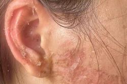 Hai người phụ nữ lãnh án tù vì đánh ghen