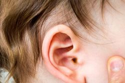 Viêm tai giữa tái phát ở trẻ không chủ quan với những yếu tố nguy cơ quen thuộc
