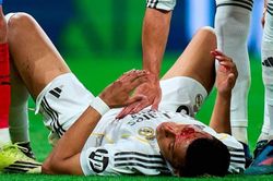 Mbappe đổ máu trên sân, Real Madrid tức giận bị 'cướp' phạt đền