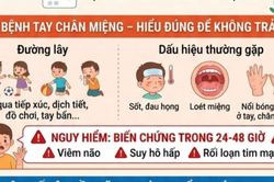 Dịch tay chân miệng gia tăng mạnh, phụ huynh cần nắm vững cách chăm sóc trẻ tại nhà