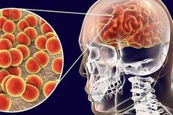 Ca bệnh do não mô cầu gia tăng