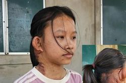 Ông bà nghèo kiệt quệ trước ca mổ lần 3 của cháu ngoại: 'Không biết vay ở đâu'