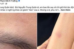 Công an xác minh thông tin ca sĩ Trung Quân Idol bị tố hành hung nữ bác sĩ