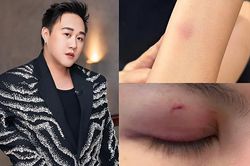 5 vụ sao Việt đánh người: Người thừa nhận say rượu, kẻ bị tát giữa phim trường