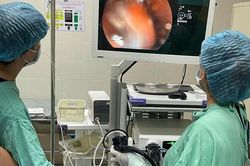 Từ ca bệnh nuốt 3 bàn chải đánh răng, cảnh báo biến chứng nguy hiểm bởi dị vật 'quá khổ'