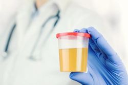 Lan truyền nguy hiểm dùng nước tiểu chữa bệnh, bác sĩ sửng sốt, cảnh báo nóng