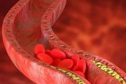 Nữ công nhân chế biến hải sản suýt phải cắt cụt chân vì đứng lâu
