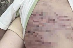 Điều tra vụ bé trai 2 tuổi nghi bị mẹ ruột và cha dượng bạo hành dã man