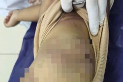 Vụ bé trai 2 tuổi bị mẹ ruột và cha dượng bạo hành: Người thân từ chối chăm sóc