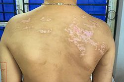Bắt tạm giam người bố bạo hành con trai hơn 7 tuổi ở Phú Thọ