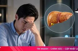 Thói quen âm thầm gây hại cho gan