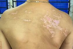Con tiếp thu bài chậm, bố dùng dây sạc điện thoại quất thâm tím người