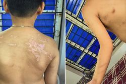 Phú Thọ: Khởi tố, bắt giam bố đẻ bạo hành con ruột gây thương tích 36%